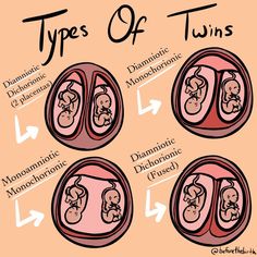 three types of twins are shown in the diagram above it is an illustration of how they interact with each other