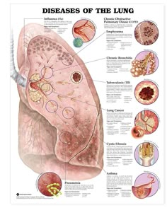 an image of the lungs and their functions in this poster, which is also labeled