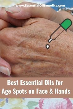 Age Spots Essential Oils, Essential Oils For Age Spots, Age Spots On Face, Essential Oils For Face, Age Spot, Spot Remover