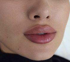 Lip Fillers Juvederm, Face Fillers, Cheek Fillers, Facial Fillers, Facial Aesthetics, Lip Filler, Botox Fillers