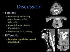 an x - ray shows the different stages of diamatia and other medical conditions