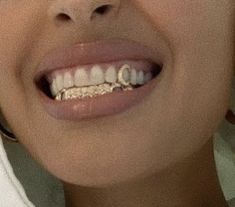 a woman with braces on her teeth