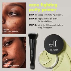 Acne Fighting Putty Face Primer | e.l.f. Cosmetics Silicone Primer, Putty Primer, Acne Moisturizer, Facial Scars, Turmeric Face Mask, Prime Skin, Elf Cosmetics, Acne Breakout, How To Apply Foundation