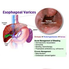 an image of the esophageal vaccies and their corresponding structures