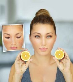 Are the dark spots on your face causing you discomfort? Looking for natural natural remedies can be of help. Lemon juice is one such ingredient to try. Read Facial Yoga, Dark Underarms, Dark Spots On Skin, Skin Spots, Spots On Face