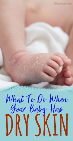 What To Do When Your Baby Has Dry Skin : One of the most common issues that can worry a newborn baby is dry skin and it’s quite normal. Before you freak out and try a hundred thousand baby creams and oils, here are some important things you need to know #newborn #babies #baby #babyhealth #dryskin Dog Dry Skin Remedy, Newborn Dry Skin, Concealer For Dry Skin, Baby Dry Skin, Best Foundation For Dry Skin, Dry Skin Diy, Dog Dry Skin, Primer For Dry Skin, Serum For Dry Skin