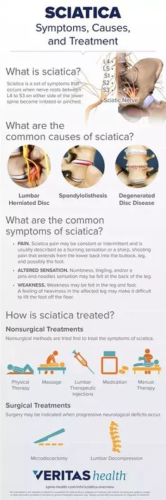 Learn about what causes sciatica, how to diagnose it, and what treatments are available. Plus, get tips on how to prevent sciatica and when to see a doctor. Inner Knee Pain, Sciatica Symptoms, Chronic Back Pain, Lower Back Pain Relief, Sciatic Nerve Pain, Knee Pain Relief