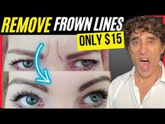 EASILY REMOVE YOUR FROWN LINES AT HOME FOR UNDER $15 - YouTube Lines On Forehead, Frown Lines, Dr Eric Berg, Face Oils, Angry Face, Skin Science, Good Health Tips, Skin Rejuvenation, Face Oil