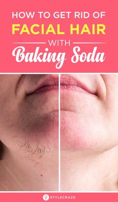 Baking Soda For Hair, Oreo Cheesecake, Beauty Tips For Skin, Unwanted Hair Removal, Natural Beauty Tips