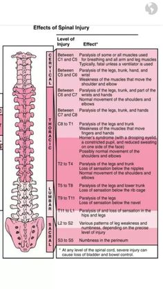 Spinal Injury, Nursing School Studying, Nursing School Tips, Medical School Studying, Nursing School Notes, Medical Terminology, Medical Anatomy, Nursing Tips