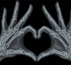 two hands in the shape of a heart with their fingers extended up to form an x - ray