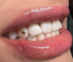 a woman's mouth with white teeth and pink gums on her lips,