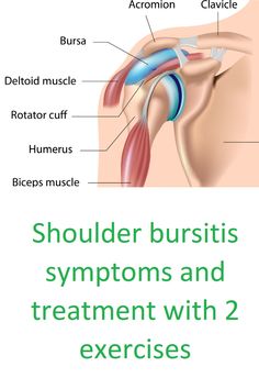 Shoulder bursitis is an uncommon but very painful cause for shoulder pain. You can find here the symptoms of shoulder bursitis and how you can treat it with 2 physical therapy exercises within 6 weeks. Check out our website for all the exercises and treatment options. Shoulder Exercises Physical Therapy