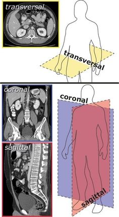 an mri scan shows the different areas of the human body and how they are used