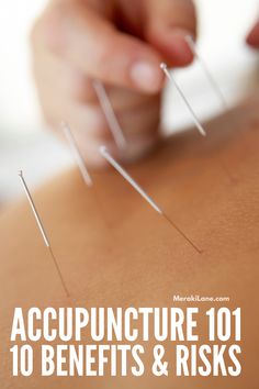 Acupuncture is commonly used to treat pain, but is also beneficial for your overall well being. Here are 10 health benefits of acupuncture. Acupuncture Benefits, Acupressure Mat, Scrub Corpo, Integrative Health, Acupuncture Points, Massage Techniques, Physical Wellness, Alternative Health, Traditional Chinese Medicine