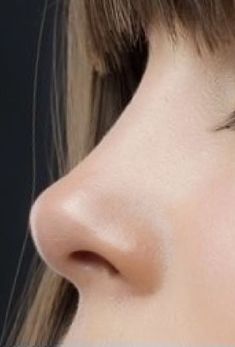 Nose Shapes, روتين العناية بالبشرة, Beauty Goals, Nose Job, Pale Skin, Dream Body