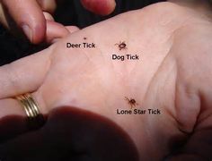 the ticks on someone's hand are marked with their name and description for each tick