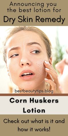 Corn Huskers Lotion : Dry Skin Remedy #cornhuskers #cornhusker #cornhuskerslotion #bestbodylotion #bodylotion #beautytips #bestbeautytips #beautysecret #dryskin #bestdryskinlotion #skindry #handslotion #footlotion #toplotion #skincare #skincareproducts #skincareproduct #bestskincare #usesofcornhuskerslotion #dryskinremedy #topskincare