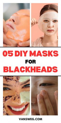 Blackheads can appear on any part of your face, but they are most common on the nose, chin, and forehead. They can make your skin look dull, uneven, and Aloe Vera For Scars, Face Masks For Blackheads, Masks For Blackheads, Face Masks Homemade, Moisturizing Routine, Diy Masks, For Blackheads, Face Mask For Blackheads, Blackhead Mask