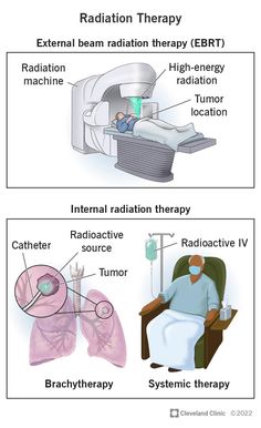 Chemo Nursing, Radiation Therapist, Nuclear Medicine, Protect Your Heart, Types Of Cancers, Cleveland Clinic, Psychiatry