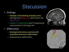 the brain and its structures are shown in this slider, which shows an image of a