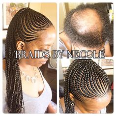 14 Extraordinary Alopecia Camouflage Cornrows By Braids By Necole African American Braid Styles, Summer Cornrows, Alopecia Hairstyles, Cornrow Ponytail, Cornrow Braids, African Blouses, African American Braids, American Hairstyles, Bald Head