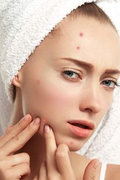 Scar Remedies, Cosmetic Fillers, Teenage Acne, Acne Products, Botox Cosmetic, Acne Overnight, Face Cream Best, Acne Skincare Routine, How To Get Rid Of Pimples