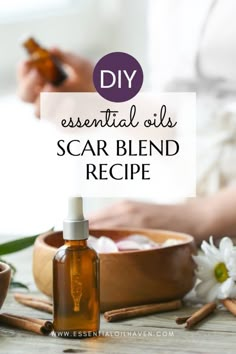 Essential Oils For Keloids, Essential Oil Scar Blend, Scar Essential Oil Blend, Scar Oil Blend, Essential Oils For Healing After Surgery, Essential Oils For Scar Tissue, Natural Scar Remedies, Essential Oils For Burns On Skin