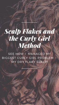 Curly Girl Problems, Dry Flaky Scalp, Natural Curly Hair Care, Healthy Curly Hair, Flaky Scalp, Create Your Own Reality, Curly Hair Photos, Hair Advice