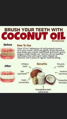 .
#dentalhealth, #dentalhealthcare Benefits Of Coconut, Coconut Oil For Teeth, Brush Your Teeth, Benefits Of Coconut Oil, Home Health Remedies, Herbs For Health, Good Health Tips, Natural Health Remedies