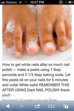 Whiten dark or stained nails #fingernails #toenails #whiten #beauty #recipes Stained Nails, Skin Care Routine For 20s, Catholic Education, Pinterest Nails, Age Gracefully, Pinterest Diy, Shellac Nails, Beauty Remedies, Foot Care