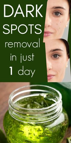 I Got Shocked With The Results Of This Magical Remedy, It Removed Dark Spot In 1 Day #darkspots #natural #diyskin #beautytipsforskin #aloevera #vitaminE Dark Spots Removal, Brown Age Spots, Brown Spots On Skin, Revision Skincare, Dark Spots On Face, Brown Spots Removal, Brown Spots On Face, Dark Spots On Skin, Skin Spots