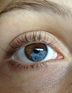 Sectoral Heterochromia, Pretty Eyes Color, Heterochromia Eyes, Head Anatomy, Eye Parts, Eyes Artwork, Eye Photography