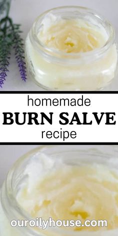 This homemade burn salve is the perfect DIY burn ointment for minor burns to help with the healing and keep the skin from scarring. Made with all-natural ingredients, this salve is great to have on hand for life’s little emergencies. Burn Salve, Our Oily House, Burn Ointment, Salve Recipes, Healing Salves, Cold Sores Remedies, Cleaner Recipes, Natural Sleep Remedies, Natural Cold Remedies