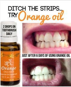 Want to whiten teeth naturally. Only 2 drops of this daily for 6 days! Essential Oil Remedy, Making Essential Oils, Whiten Teeth, Oil Remedies, Essential Oils Health, Yl Essential Oils, Oil Pulling, Living Essentials Oils, Natural Teeth Whitening