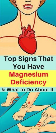 Magnesium Deficiency, Muscle Spasms, Bone Health, Health Issues, Health Remedies, Healthy Tips, Natural Health, Home Remedies, Health Benefits