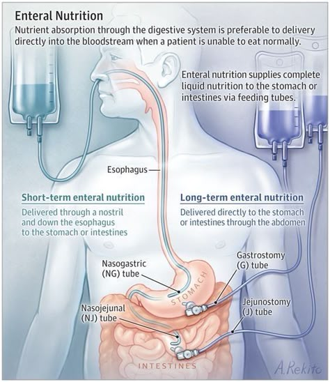 Nurse Teaching, Nursing School Essential, Nursing Mnemonics, Nursing Student Tips, Medical Surgical Nursing, Nursing School Survival, Nursing School Studying, Med Surg, Nursing School Tips