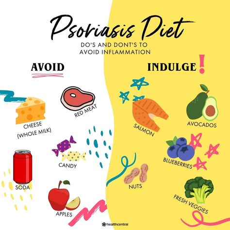 Psiorasis Diet, Psoriatic Diet, Psoriatic Skin Remedies, Psoriatic Skin Diet, Pyloric Stenosis, Psoriatic Skin, Excema Diet, Western Foods, How To Treat Inflammatory Acne