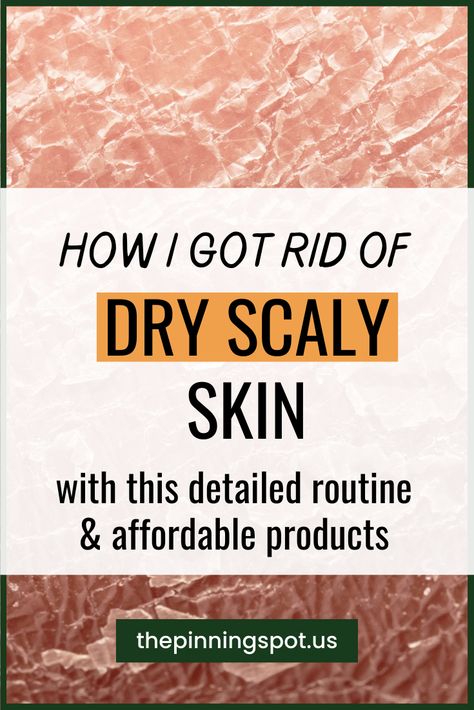 I caused my dry scaly skin trying to get rid of my oily skin. And so to get rid of my dry, scaly skin on face and legs I used this budget-friendly care routine as well as moisturizers to hydrate my skin. These are all the solutions to my dry scaly skin I used, what worked to get rid of my dry scaly skin and what did not work. I hope you find this helpful as you tackle your dry ashy skin. Let's get into it. Skincare Routine For Dry Dull Skin, Best Dry Skin Products, Scaly Legs Remedy Dry Skin, Natural Dry Skin Remedies, Extremely Dry Skin Remedies, Skincare Routine Dry Sensitive Skin, How To Help Dry Skin, Face Oils For Dry Skin, Dry Legs Remedy How To Get Rid