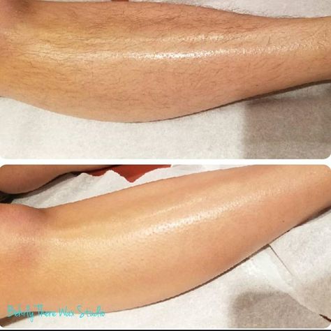 Before and after leg wax. Look how smooth you can be! #dayton #ohio #brazilianwaxing #waxing #esthetician #eyebrowwaxing #lashlift #lashtint #browtint #legwax #beforeandafter Hair Removal Scrub, Baking Soda Recipes, Waxing Esthetician, Leg Hair Removal, Wax Studio, Hair Removal Diy, Summer Hawaii, Lash Tint, Anti Aging Body