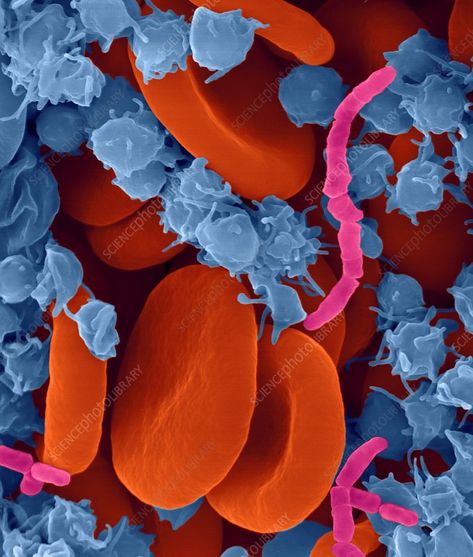 Blood Infection, Septic Shock, Scanning Electron Micrograph, Microscopic Photography, Body Tissues, Science Photos, Red Blood, Circulatory System, Red Blood Cells