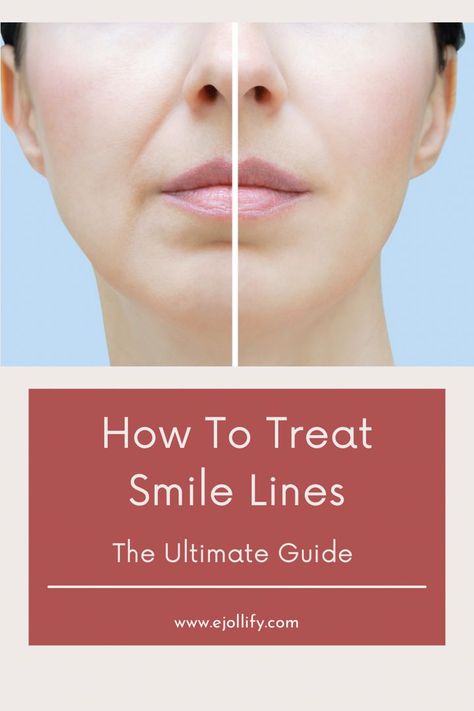 How To Get Rid of Smile Lines • Treatments & Skincare Best Products For Smile Lines, Facial Lines Around Mouth, Lines Around Mouth How To Get Rid, Fine Lines Around Mouth, Getting Rid Of Frown Lines, Reduce Laugh Lines, Filler Around Mouth, Filler For Nasolabial Folds, Filler Nasolabial Folds