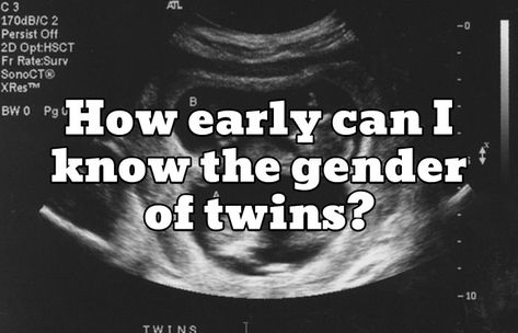 Recently, I was asked by a dad expecting twins, “How early can I know the gender of twins?” There are really two ways to determine the gender of your twins, one via blood work and the other via ultrasound. Let’s see what each of those mean for your twin gender reveal: Twin Gender Determination via […] Identical Twins Ultrasound, Ultrasound Gender Prediction, Ramzi Theory, Twins Ultrasound, Gender Reveal Twins, Twins Gender Reveal, Ultrasound Gender, 12 Week Scan, Gender Determination