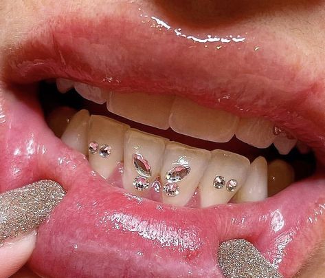 Butterfly Tooth Gem, Iridescent Design, Pretty Teeth, Grillz Teeth, Gem Tattoo, Diamond Teeth, Tooth Gems, Grills Teeth, Tooth Gem