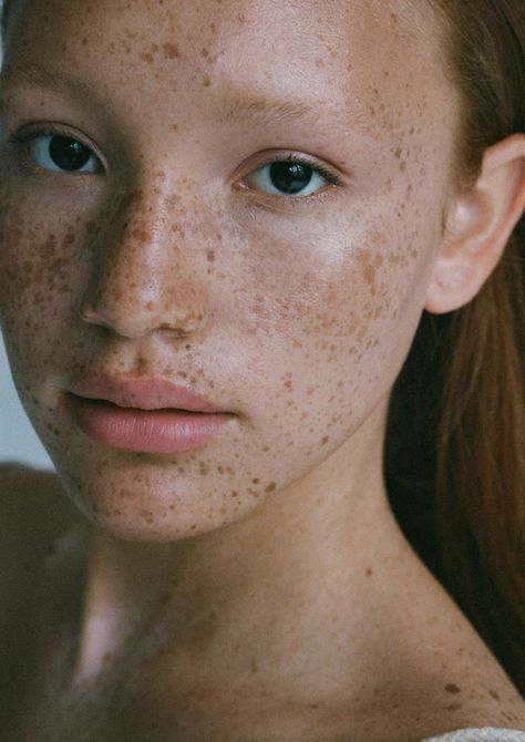 Tehya Elam, Fenty Campaign, Women With Freckles, Mario Badescu Facial Spray, Surrender To God, Pomegranate Oil, White Chicks, African Models, Facial Spray