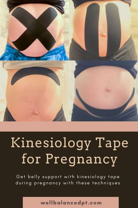 With additonal weight in your abdomen, using kinesiology tape can help take pressure off your stomach and low back to reduce pain and discomfort. Click to read more information. Kinestiotape, Pregnancy, Stomach Support, Low back pain and pregnancy. K Tape Pregnancy, Pregnancy Tape Belly, Pregnancy Belly Taping, Belly Taping For Pregnancy, Kinesiology Taping Pregnancy, Kt Tape Pregnancy, Pregnancy Running, Pregnancy Back Pain, K Tape