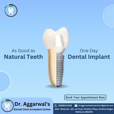 Dental Implants Creative Ads, Dental Content, Coffee Advertising, Dental Posts, Teeth Implants, Digital Marketing Design, Logo Design Inspiration Branding, Dental Implant, Jaw Bone