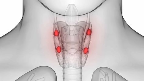 In humans there are four pea-sized parathyroid glands embedded in the thyroid gland, these organs all form a butterfly-shaped that consists of two lobes located at either side of the trachea (windpipe). They are all located in the neck region of the human body just at the front below the larynx (Adam’s apple). Even though [�…] Total Thyroidectomy, Parathyroid Disease, Thyroid Surgery, Rare Disorders, Graves Disease, Thyroid Gland, Hormone Replacement, Patient Experience, The Human Body