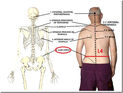 Bony Landmarks, Iliac Crest, Thoracic Cage, Surface Anatomy, Muscles Anatomy, Sternocleidomastoid Muscle, Pelvic Bone, Physical Therapist Assistant, Physical Therapy Assistant