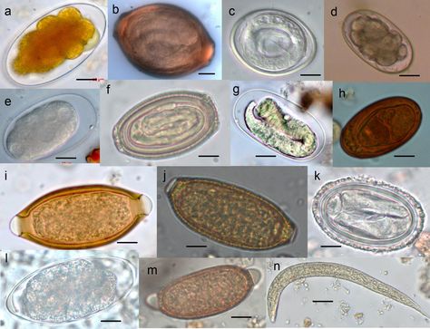 Veterinary Parasitology, Liver Fluke, Microbiology Study, Medical Lab Technician, Veterinary Tech, Fever Symptoms, Microbiology Lab, Pav Recipe, Medical Laboratory Scientist